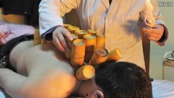 拔罐视频在线观看,跟随视频学习拔罐技巧与体验 第3张 拔罐视频在线观看,跟随视频学习拔罐技巧与体验 第3张